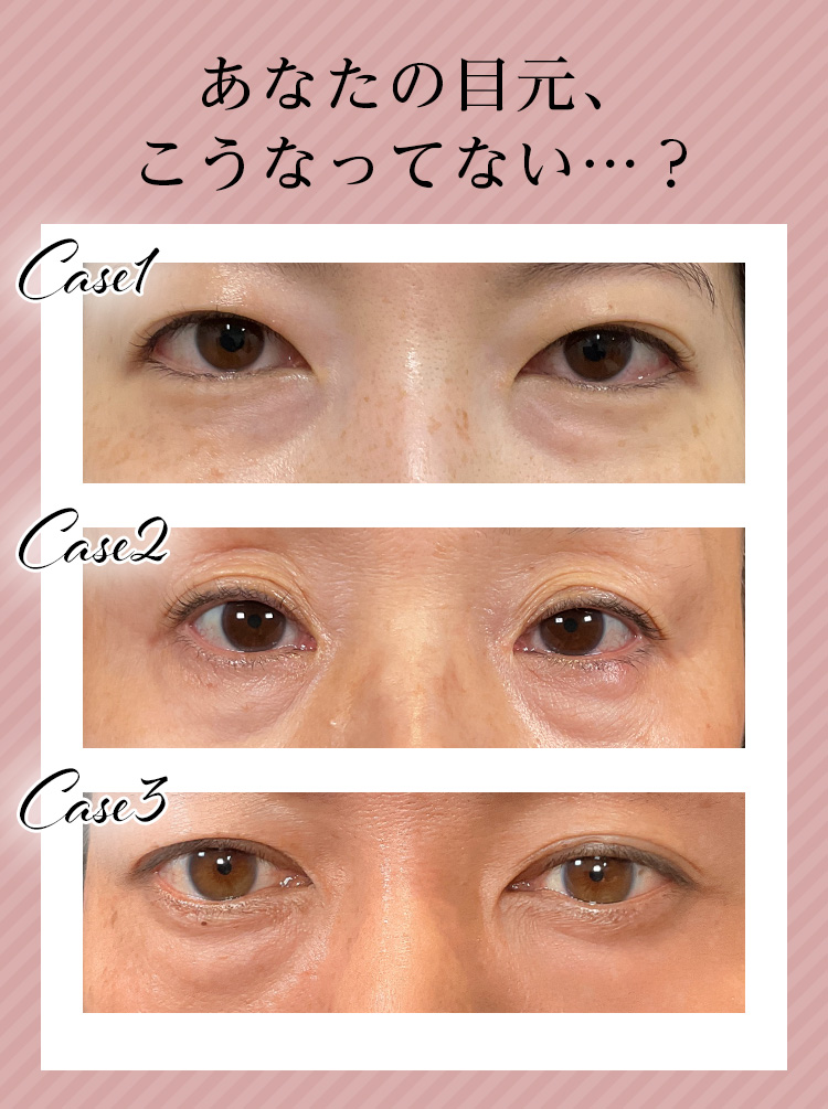 あなたの目元、こうなってない…？