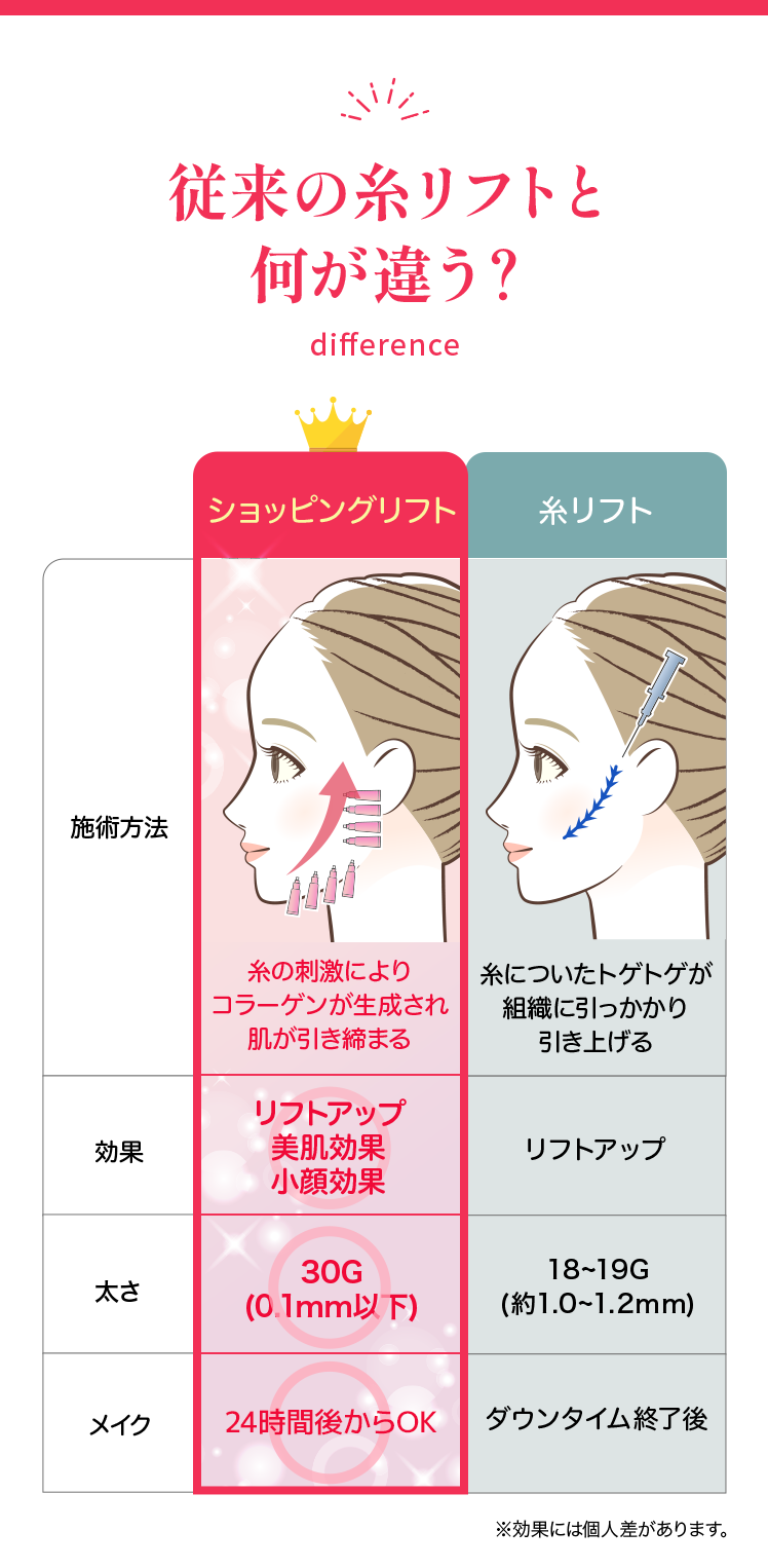 従来の糸リフトと何が違う?