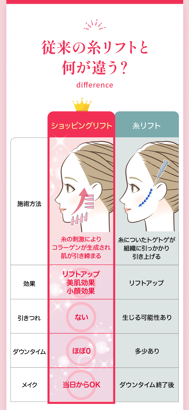 従来の糸リフトと何が違う？