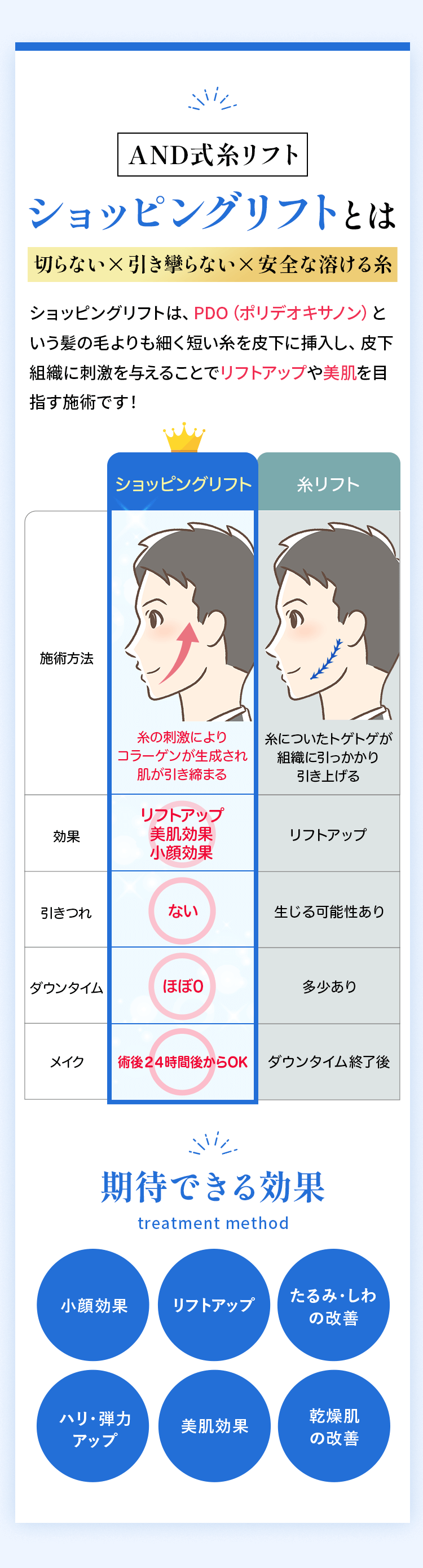 AND式糸リフト ショッピングリフトとは