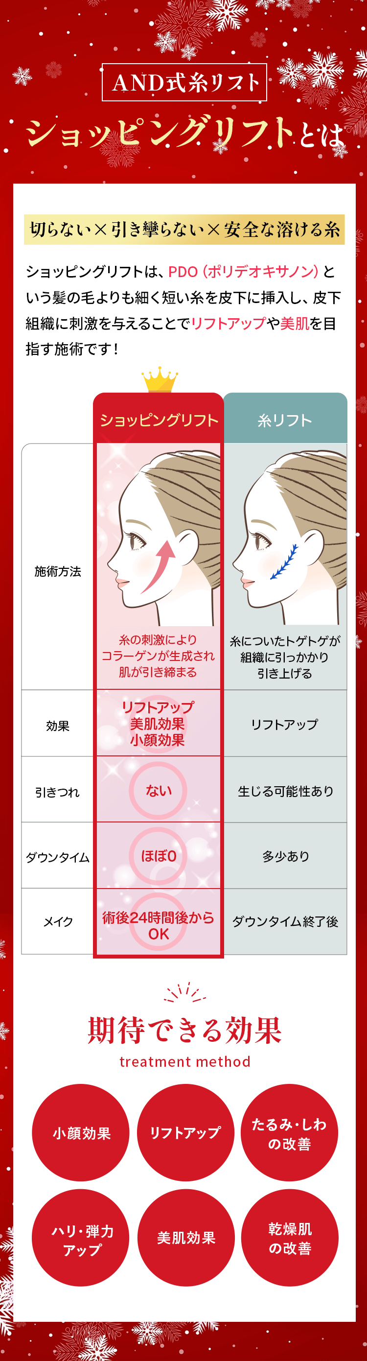 AND式糸リフト ショッピングリフトとは
