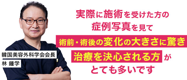 実際に施術を受けた方の症例写真を見て術前・術後の変化の大きさに驚き治療を決心される方がとても多いです