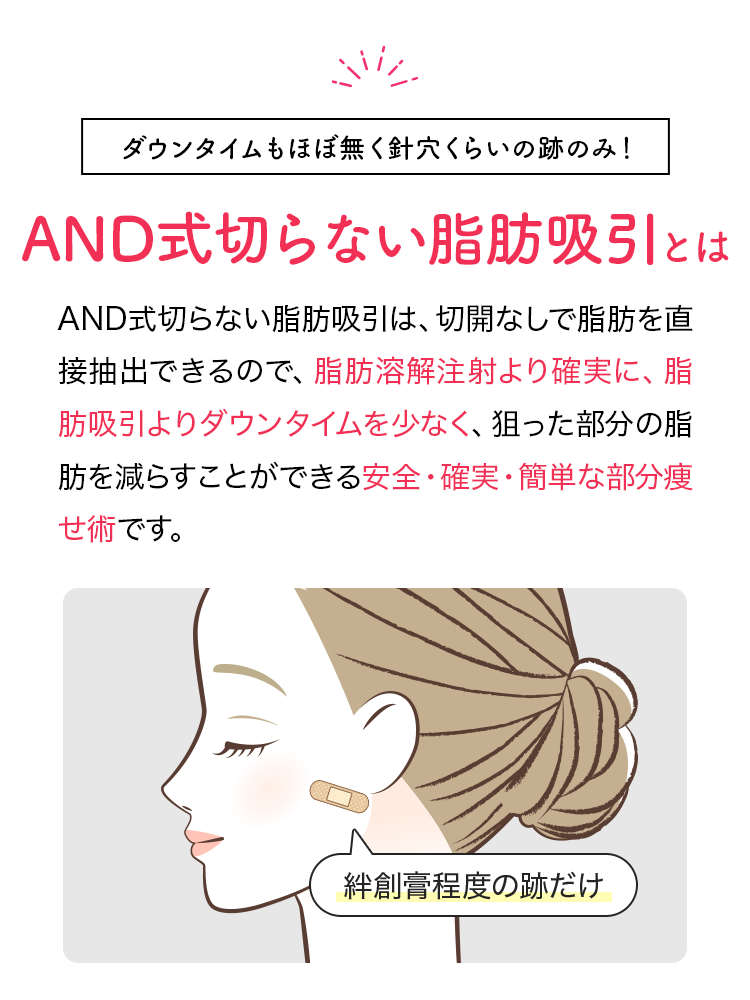 AND式切らない脂肪吸引とは